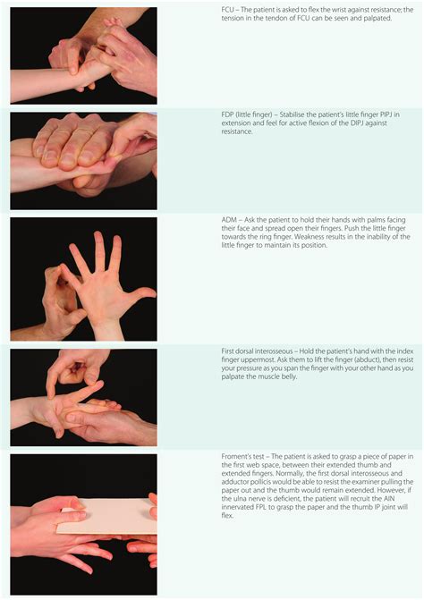 ulnar nerve test physical therapy